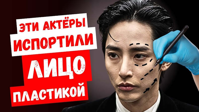 Теперь их не узнать. Корейские актёры, которые не смогли сохранить свою природную красоту: НОВОСТИ