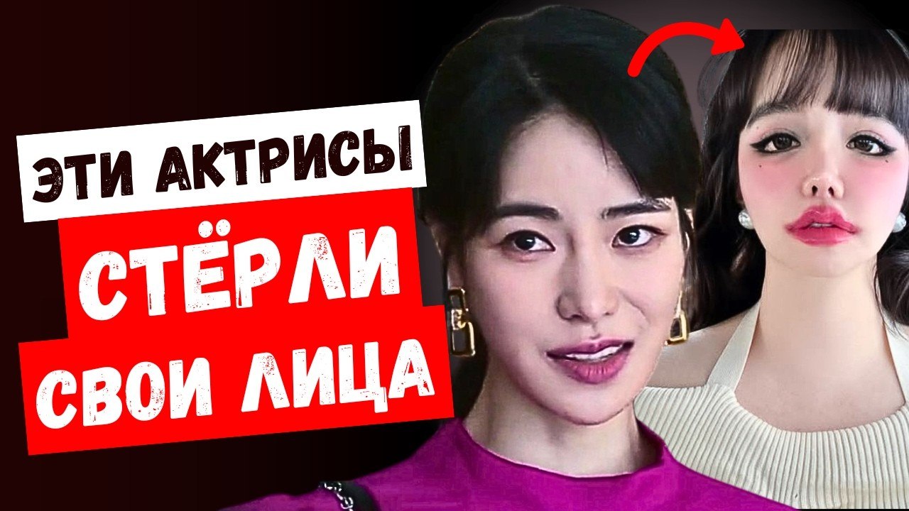 Жёсткая корейская пластика: на что идут актрисы ради популярности?