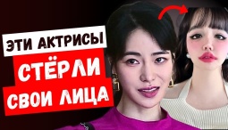 Жёсткая корейская пластика: на что идут актрисы ради популярности?